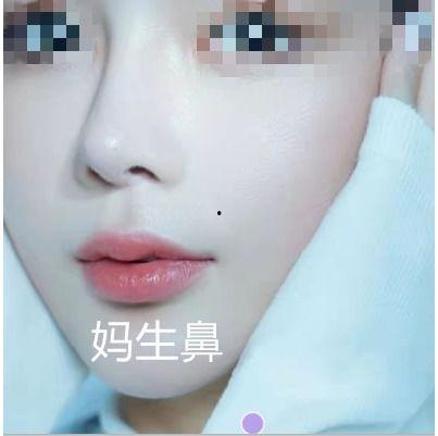 网红做鼻子感染那个是谁,揭秘网红鼻整形背后的风险与教训